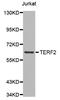 Telomeric Repeat Binding Factor 2 antibody, LS-C330806, Lifespan Biosciences, Western Blot image 