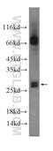 Myc target protein 1 antibody, 22004-1-AP, Proteintech Group, Western Blot image 
