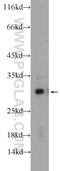 GID Complex Subunit 8 Homolog antibody, 24479-1-AP, Proteintech Group, Western Blot image 