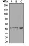 FAM20A Golgi Associated Secretory Pathway Pseudokinase antibody, LS-C668319, Lifespan Biosciences, Western Blot image 