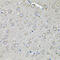 Eukaryotic translation initiation factor 3 subunit C antibody, 22-638, ProSci, Immunohistochemistry paraffin image 