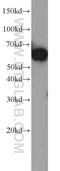 PRK1 antibody, 21401-1-AP, Proteintech Group, Western Blot image 