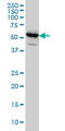 Solute Carrier Family 6 Member 11 antibody, LS-C197875, Lifespan Biosciences, Western Blot image 