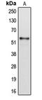 Cytochrome P450 2B6 antibody, LS-C352084, Lifespan Biosciences, Western Blot image 