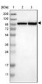 Ubiquitin Specific Peptidase 4 antibody, PA5-53820, Invitrogen Antibodies, Western Blot image 