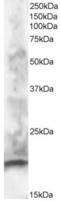 Calcium Binding Protein 1 antibody, EB05578, Everest Biotech, Western Blot image 