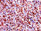 GAPDH antibody, A52409-100, Epigentek, Immunohistochemistry paraffin image 