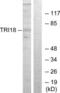 Midline 1 antibody, LS-C118672, Lifespan Biosciences, Western Blot image 