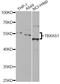 Thromboxane A Synthase 1 antibody, LS-C748415, Lifespan Biosciences, Western Blot image 