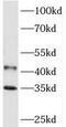 Phytanoyl-CoA 2-Hydroxylase Interacting Protein antibody, FNab06413, FineTest, Western Blot image 