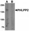 PH Domain And Leucine Rich Repeat Protein Phosphatase 2 antibody, TA319840, Origene, Western Blot image 