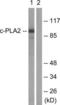Phospholipase A2 Group IVA antibody, LS-B7555, Lifespan Biosciences, Western Blot image 
