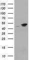 Epoxide Hydrolase 1 antibody, TA800407, Origene, Western Blot image 