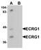 Transmembrane Serine Protease 11A antibody, PA5-72715, Invitrogen Antibodies, Western Blot image 