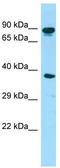 Hook Microtubule Tethering Protein 3 antibody, TA337953, Origene, Western Blot image 