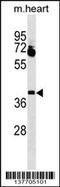 Ladybird Homeobox 1 antibody, 59-739, ProSci, Western Blot image 