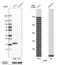 Membrane attack complex inhibition factor antibody, HPA026494, Atlas Antibodies, Western Blot image 