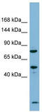 PDZ Domain Containing Ring Finger 3 antibody, TA329848, Origene, Western Blot image 