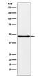 NPHS2 Stomatin Family Member, Podocin antibody, M01445-1, Boster Biological Technology, Western Blot image 