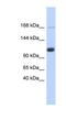 U2 SnRNP Associated SURP Domain Containing antibody, NBP1-70714, Novus Biologicals, Western Blot image 