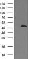 Calreticulin 3 antibody, TA505888S, Origene, Western Blot image 