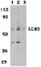 C-C chemokine receptor type 3 antibody, MBS150409, MyBioSource, Western Blot image 