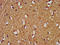 Hes Related Family BHLH Transcription Factor With YRPW Motif 1 antibody, LS-C673705, Lifespan Biosciences, Immunohistochemistry paraffin image 