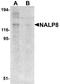 NLR Family Pyrin Domain Containing 8 antibody, A15112, Boster Biological Technology, Western Blot image 