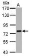 Poly(ADP-Ribose) Polymerase Family Member 6 antibody, GTX122488, GeneTex, Western Blot image 