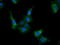 Caseinolytic Mitochondrial Matrix Peptidase Proteolytic Subunit antibody, TA502062, Origene, Immunofluorescence image 