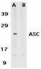 PYD And CARD Domain Containing antibody, TA306044, Origene, Western Blot image 