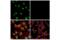 Zinc Finger E-Box Binding Homeobox 1 antibody, 70512S, Cell Signaling Technology, Immunocytochemistry image 