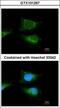 Glucosylceramidase Beta antibody, GTX101267, GeneTex, Immunofluorescence image 