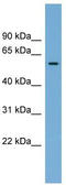 Interferon Induced Protein 44 antibody, TA339298, Origene, Western Blot image 