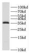 Enolase-Phosphatase 1 antibody, FNab02769, FineTest, Western Blot image 