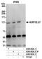 DLG Associated Protein 5 antibody, A300-852A, Bethyl Labs, Immunoprecipitation image 