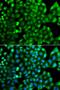 MHC II HLA-DR beta antibody, orb373689, Biorbyt, Immunofluorescence image 