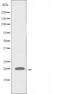 Exostosin Glycosyltransferase 1 antibody, orb228899, Biorbyt, Western Blot image 