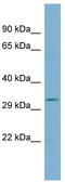 Spectrin Repeat Containing Nuclear Envelope Family Member 4 antibody, TA335981, Origene, Western Blot image 