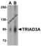 Ring Finger Protein 216 antibody, 3371, ProSci, Western Blot image 