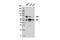 Yes Associated Protein 1 antibody, 8418S, Cell Signaling Technology, Western Blot image 