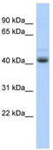 Homeobox protein PKNOX1 antibody, TA334737, Origene, Western Blot image 