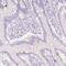 LON Peptidase N-Terminal Domain And Ring Finger 3 antibody, PA5-62188, Invitrogen Antibodies, Immunohistochemistry paraffin image 