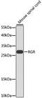 Retinal G Protein Coupled Receptor antibody, A7925, ABclonal Technology, Western Blot image 