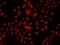 F-Box And WD Repeat Domain Containing 11 antibody, GTX33193, GeneTex, Immunofluorescence image 
