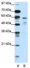 Nuclear Receptor Subfamily 1 Group H Member 3 antibody, TA343557, Origene, Western Blot image 