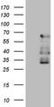 Calcium/Calmodulin Dependent Protein Kinase II Beta antibody, TA808428S, Origene, Western Blot image 
