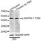 Mitogen-Activated Protein Kinase Kinase 1 antibody, STJ22233, St John