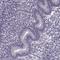Probable inactive serine protease 37 antibody, HPA020541, Atlas Antibodies, Immunohistochemistry paraffin image 