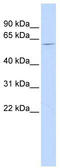 5'-Nucleotidase, Cytosolic IB antibody, TA344250, Origene, Western Blot image 